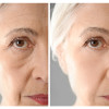 Ser antirid, Wrinkle Filler, cu acid Hialuronic si Vitamina A, Life Care®